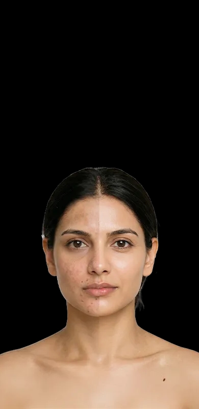 Woman showing skin transformation — dermatologist-led treatment results