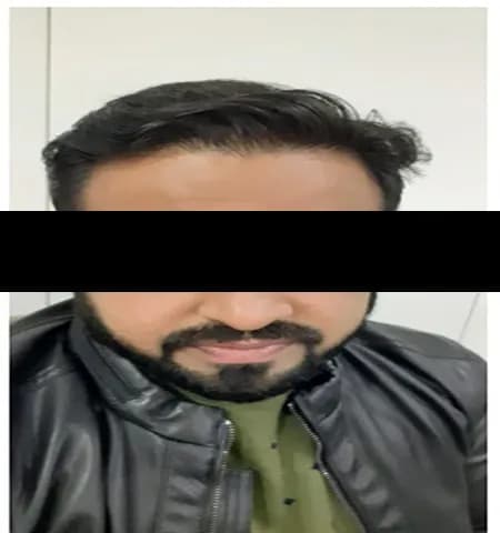 After treatment