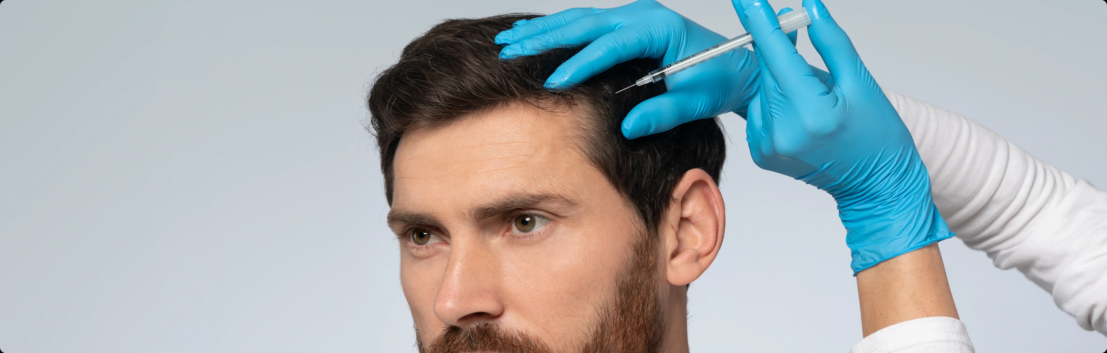 PRP hair results