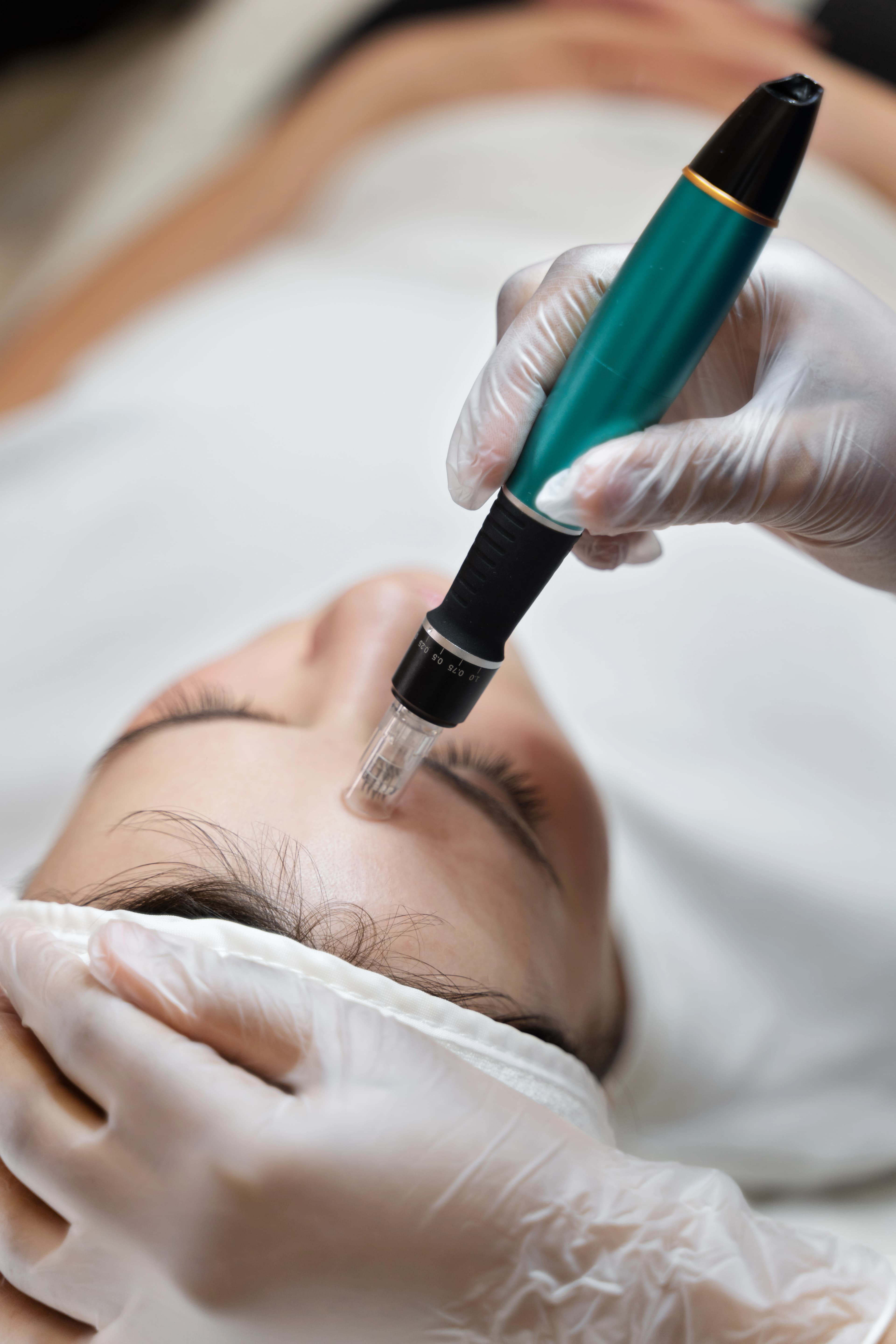 Mesotherapy treatment
