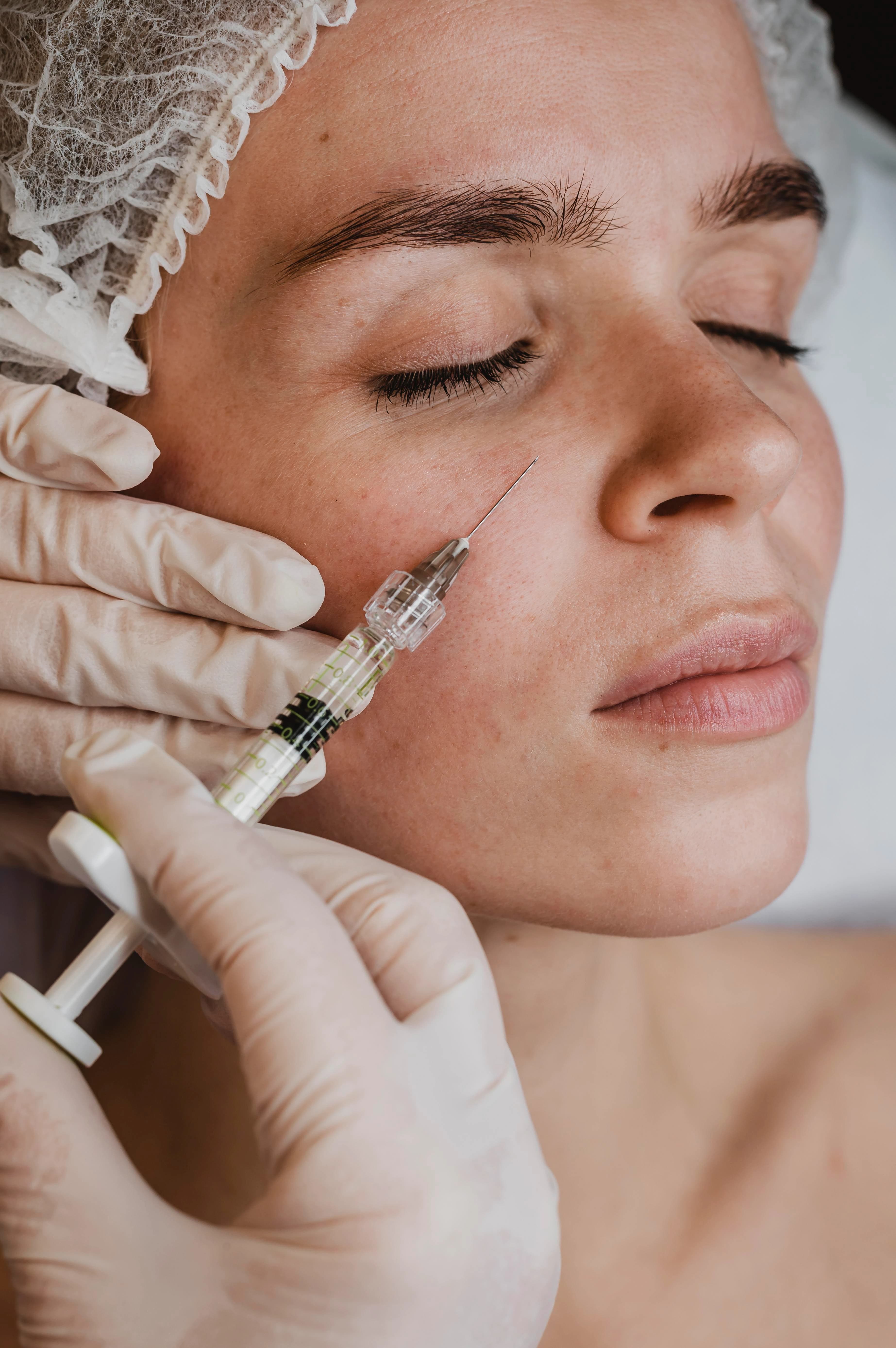 Skin Booster treatment