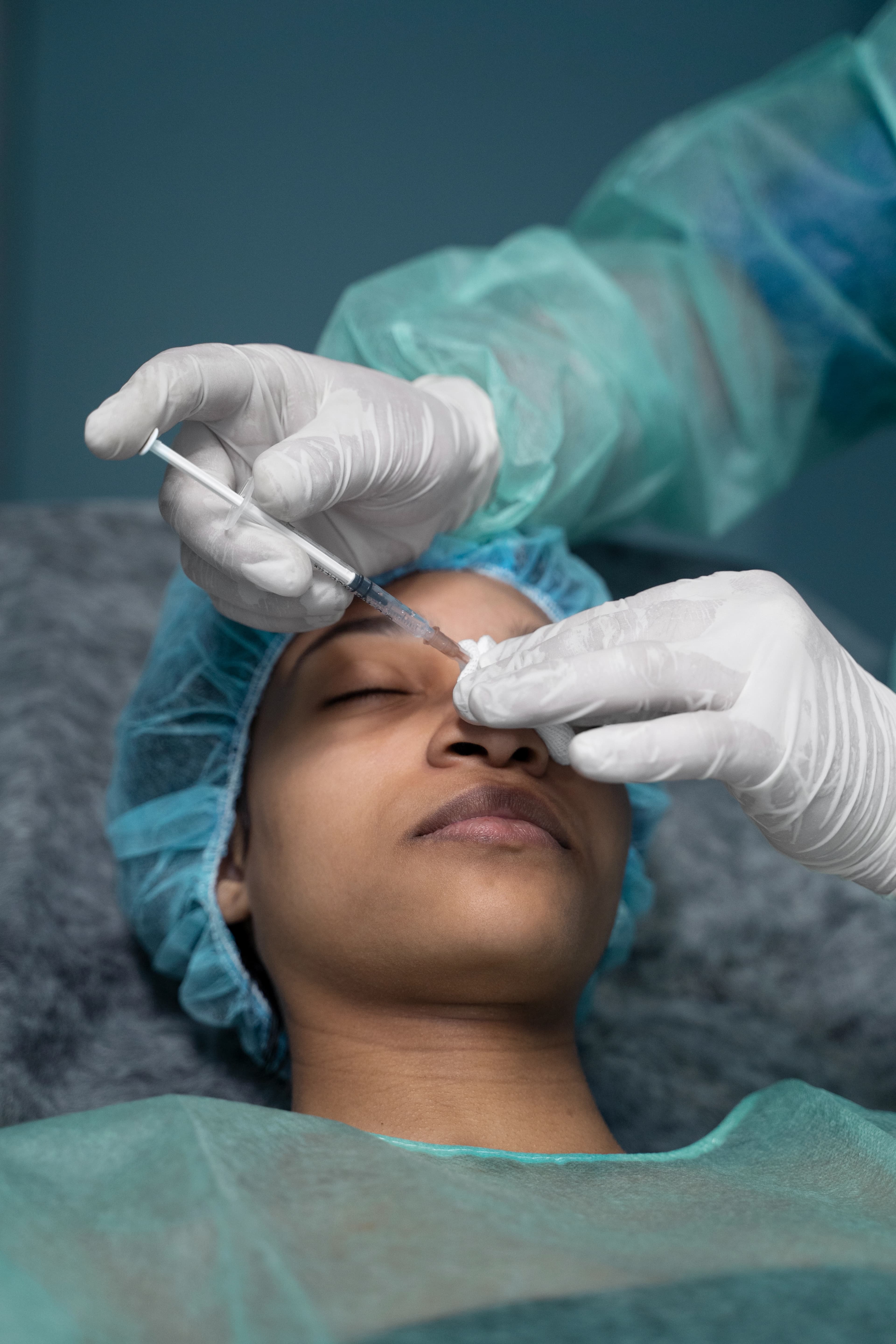 Subcision treatment